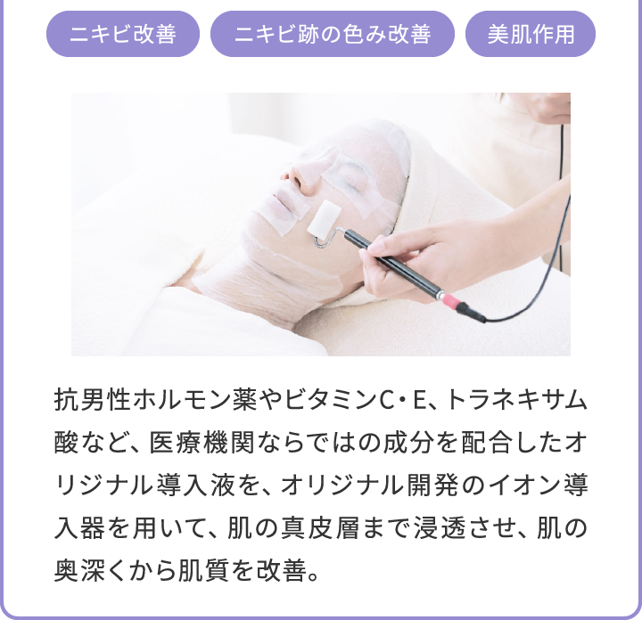 acc_01_content