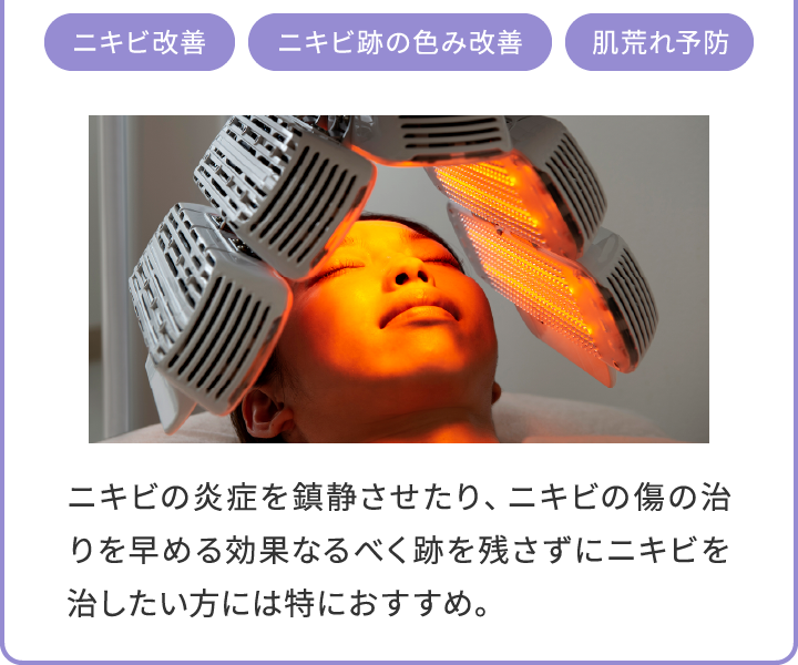 acc_02_content
